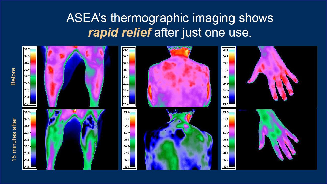 REDOXGold Thermographic Imaging
